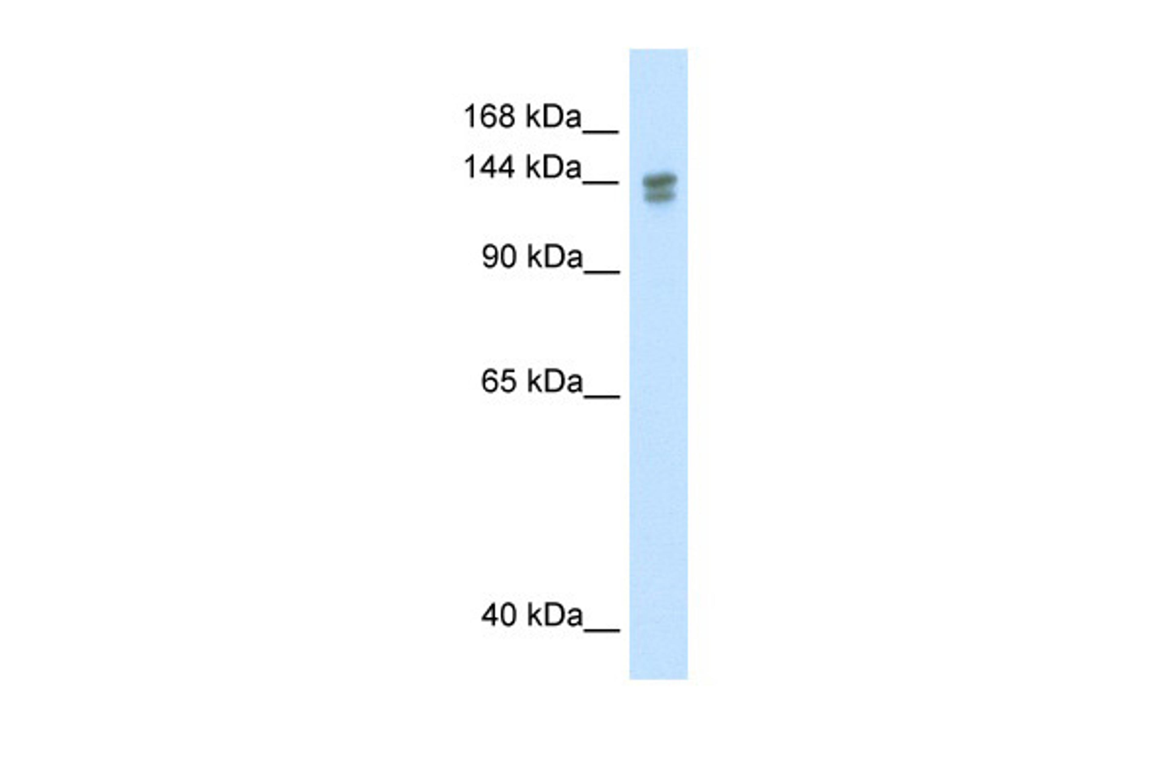 Antibody used in WB on Human Thymus at 0.2-1 ug/ml.