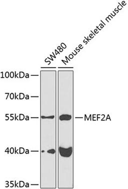 Western blot - MEF2A antibody (A7911)