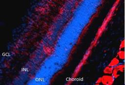 Immunocytochemistry/Immunofluorescence: Nitrotyrosine Antibody (39B6) [NB110-96877] - Visualized on a retinal injury