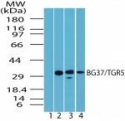 Western Blot: TGR5 Antibody [NBP2-23669] - Analysis of TGR5 in spleen lysate.  Lane 1 shows pre-immune sera.  Lanes 2, 3 and 4 show TGR5 antibody tested on human (1:1000), mouse (1:5000) and rat (1:5000) spleen lysate, respectively.