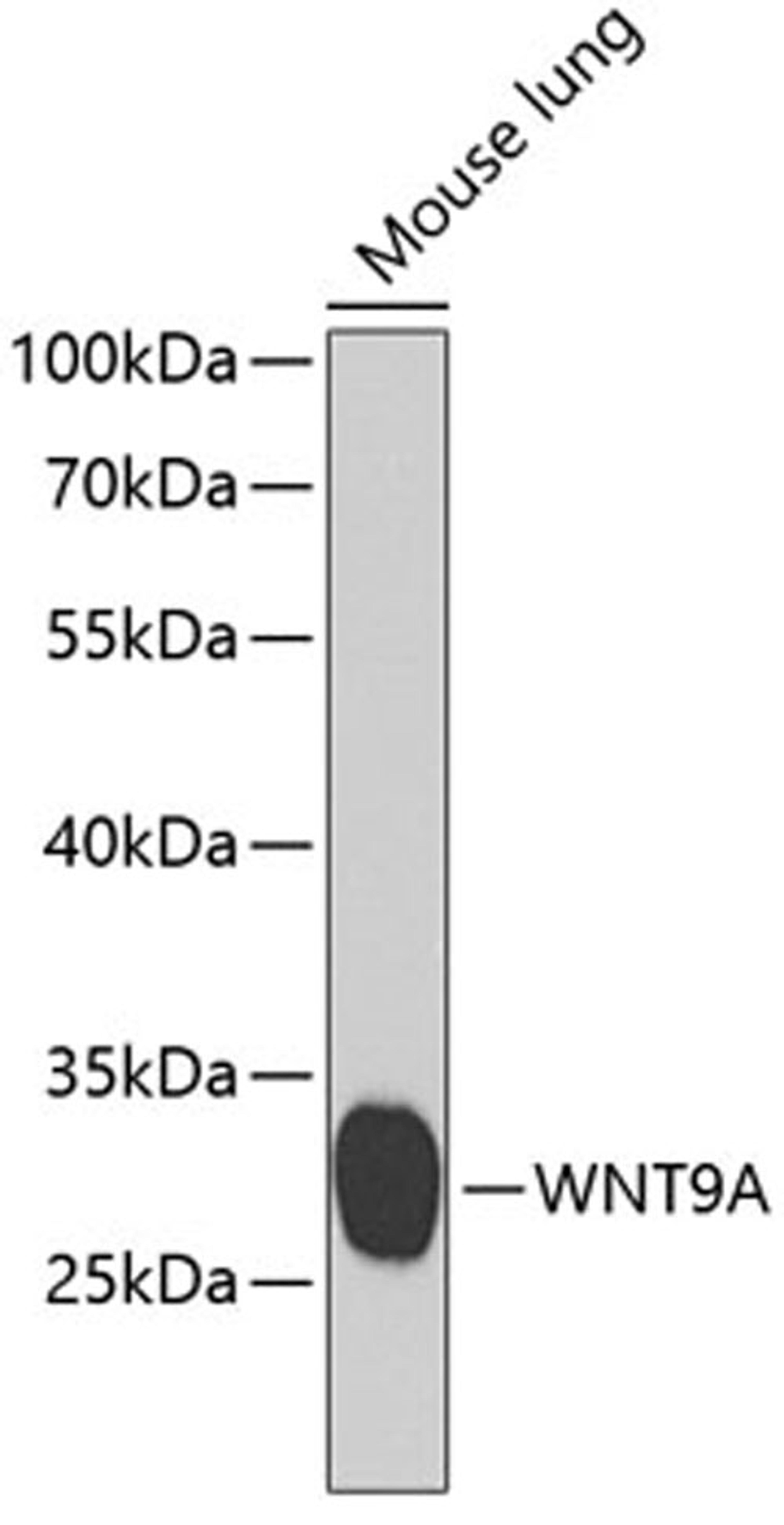 Western blot - WNT9A antibody (A7939)