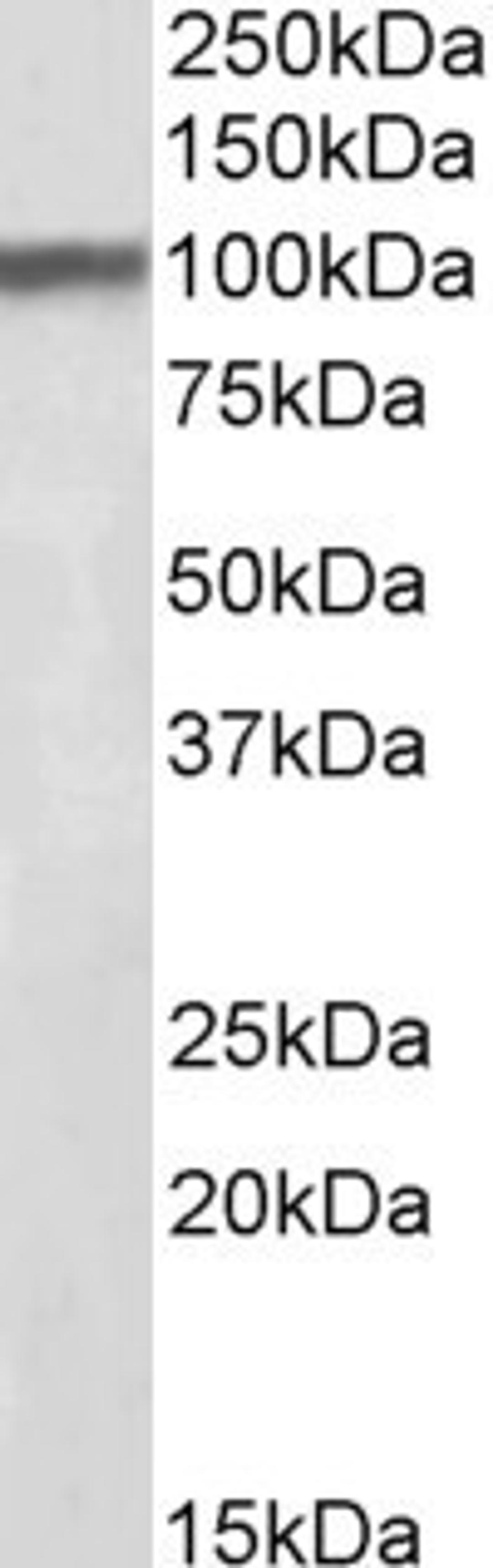 45-722 (0.1ug/ml) staining of Mouse Brain lysate (35ug protein in RIPA buffer). Primary incubation was 1 hour. Detected by chemiluminescence.