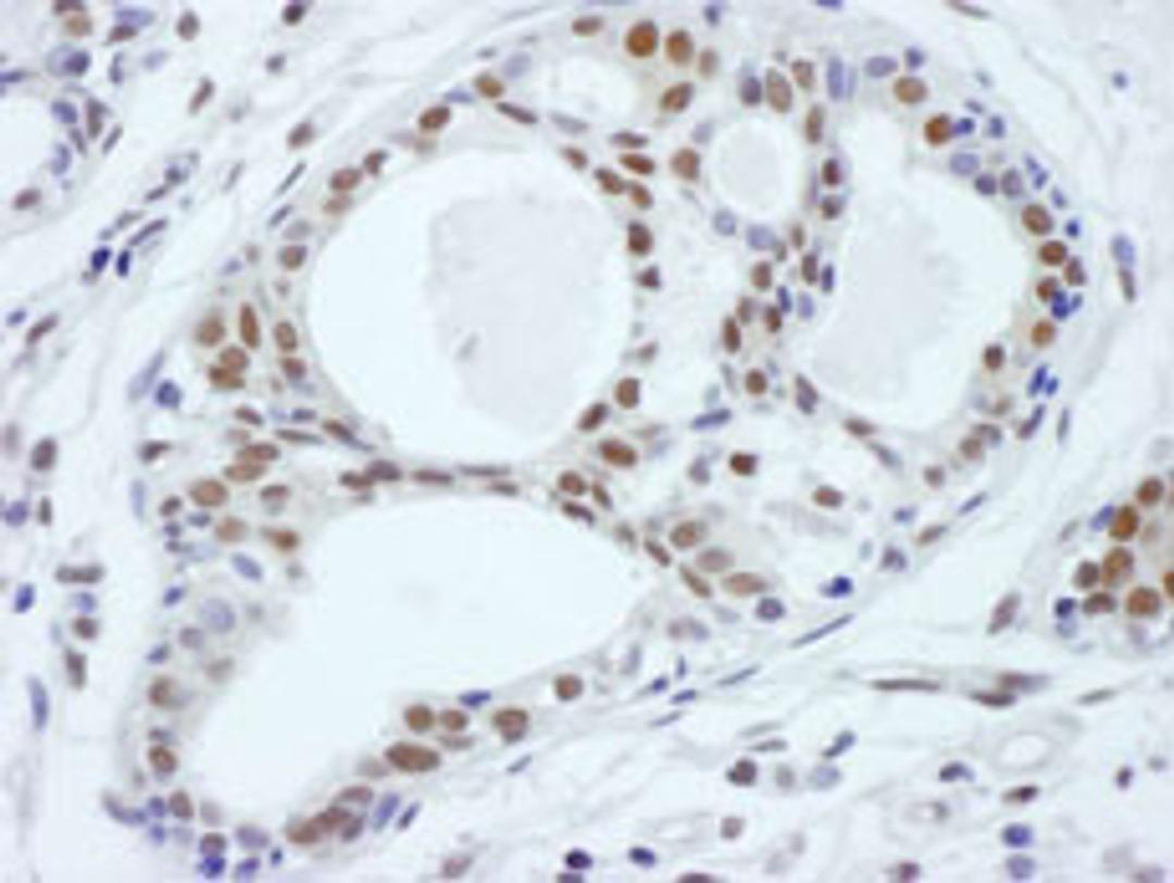 Detection of human ASH2 by immunohistochemistry.