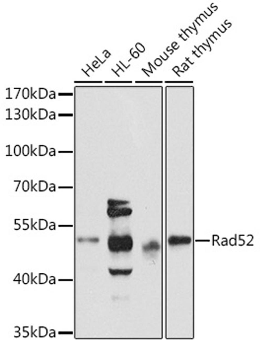 Western blot - Rad52 antibody (A3077)