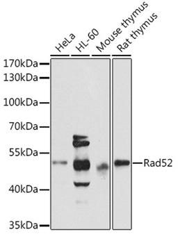 Western blot - Rad52 antibody (A3077)