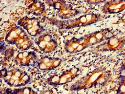 Immunohistochemistry of paraffin-embedded human small intestine tissue using CSB-PA009703LA01HU at dilution of 1:100