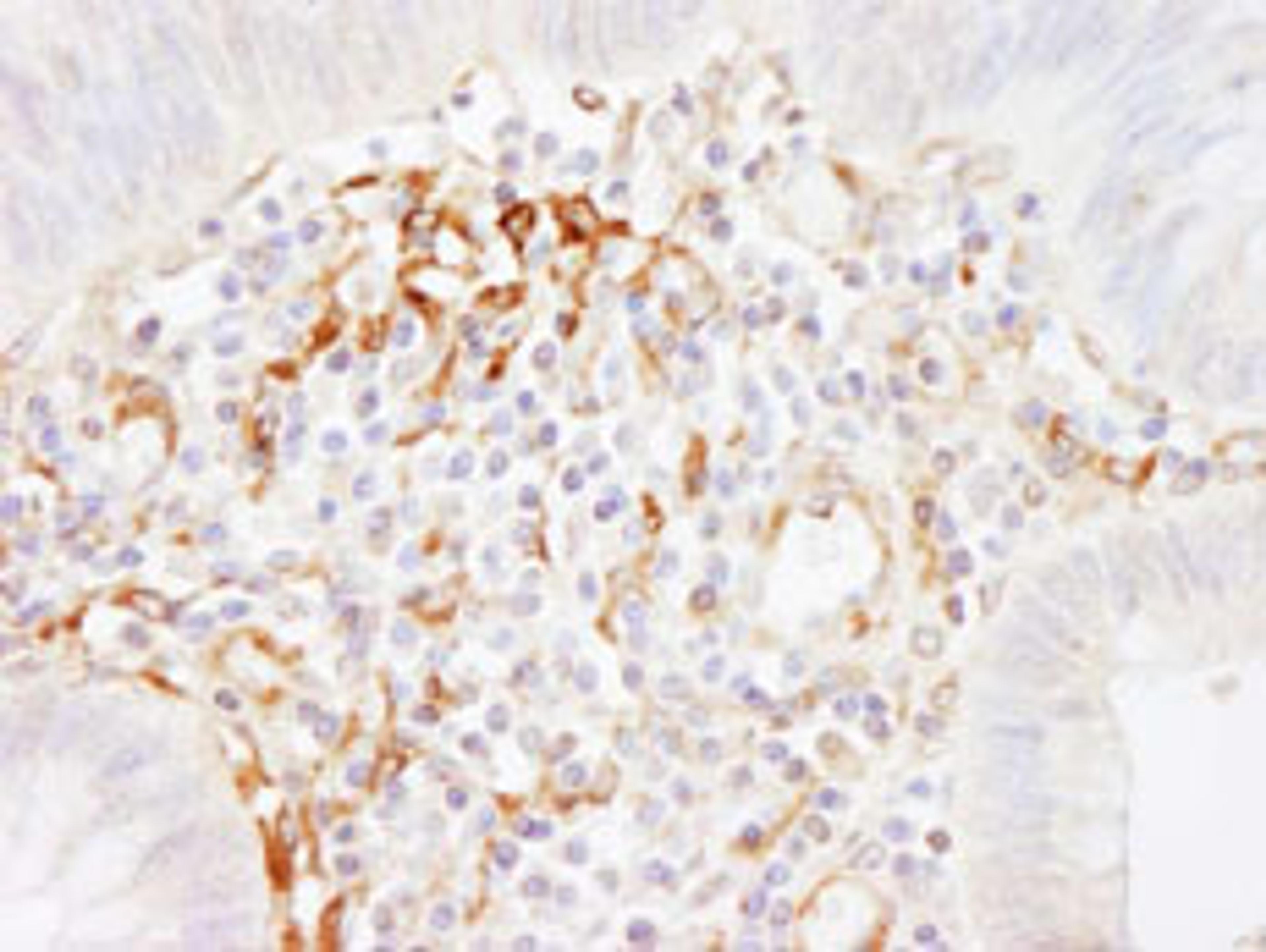 Detection of human Filamin A by immunohistochemistry.