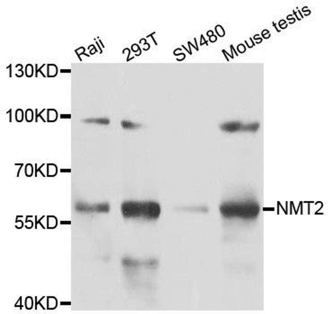 WB analysis of extracts of various cell lines using NMT2 antibody