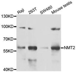 WB analysis of extracts of various cell lines using NMT2 antibody