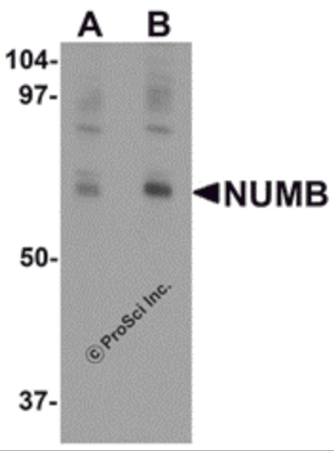 Western blot analysis of NUMB in mouse lung tissue lysate with NUMB antibody at (A) 0.25 and (B) 0.5 μg/mL.