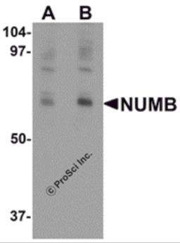 Western blot analysis of NUMB in mouse lung tissue lysate with NUMB antibody at (A) 0.25 and (B) 0.5 μg/mL.