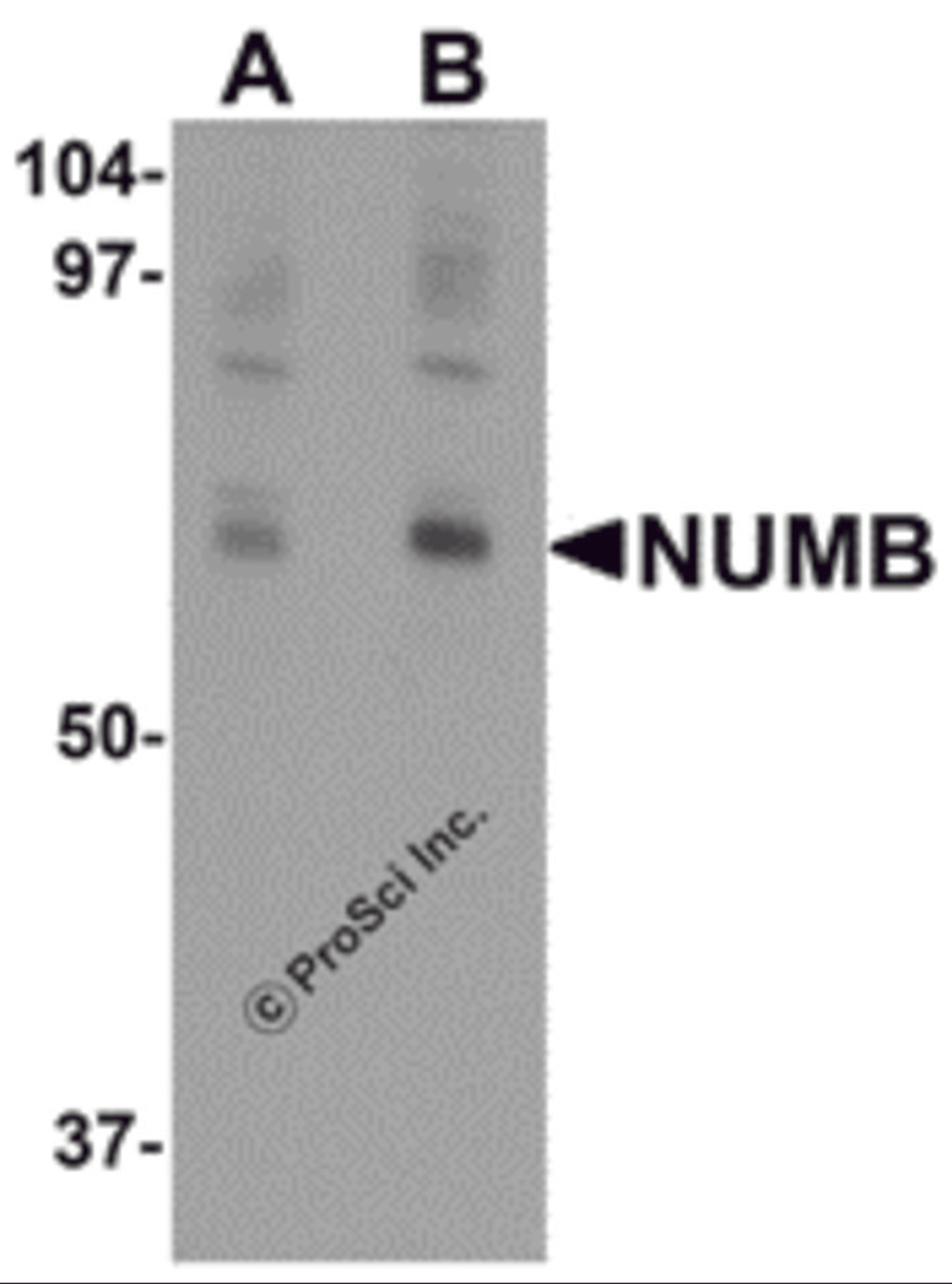 Western blot analysis of NUMB in mouse lung tissue lysate with NUMB antibody at (A) 0.25 and (B) 0.5 μg/mL.