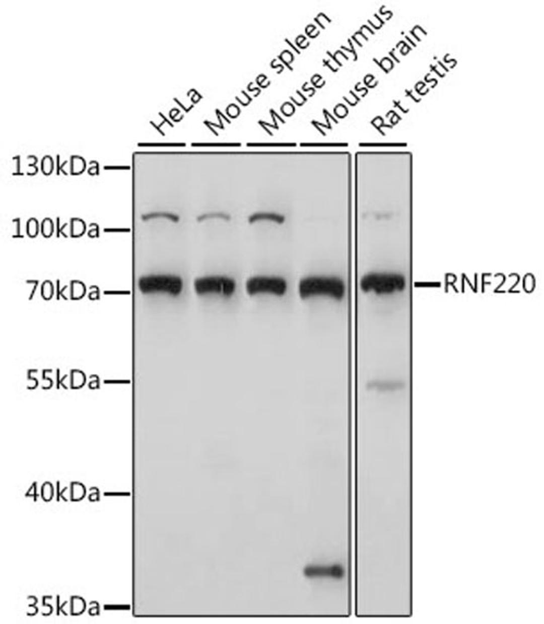 Western blot - RNF220 antibody (A15853)