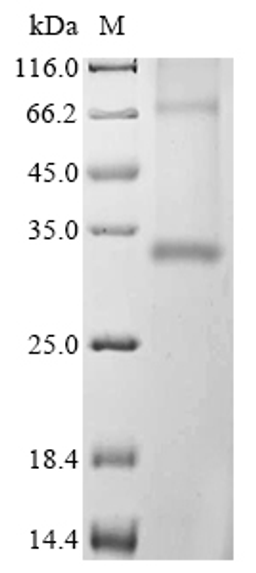 (Tris-Glycine gel) Discontinuous SDS-PAGE (reduced) with 5% enrichment gel and 15% separation gel.