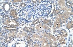 Immunohistochemistry-Paraffin: SARDH Antibody [NBP1-70769] - Human kidney Tissue, antibody concentration 4-8ug/ml. Cells with positive label: renal corpuscle cells (indicated with arrows) 400X magnification.