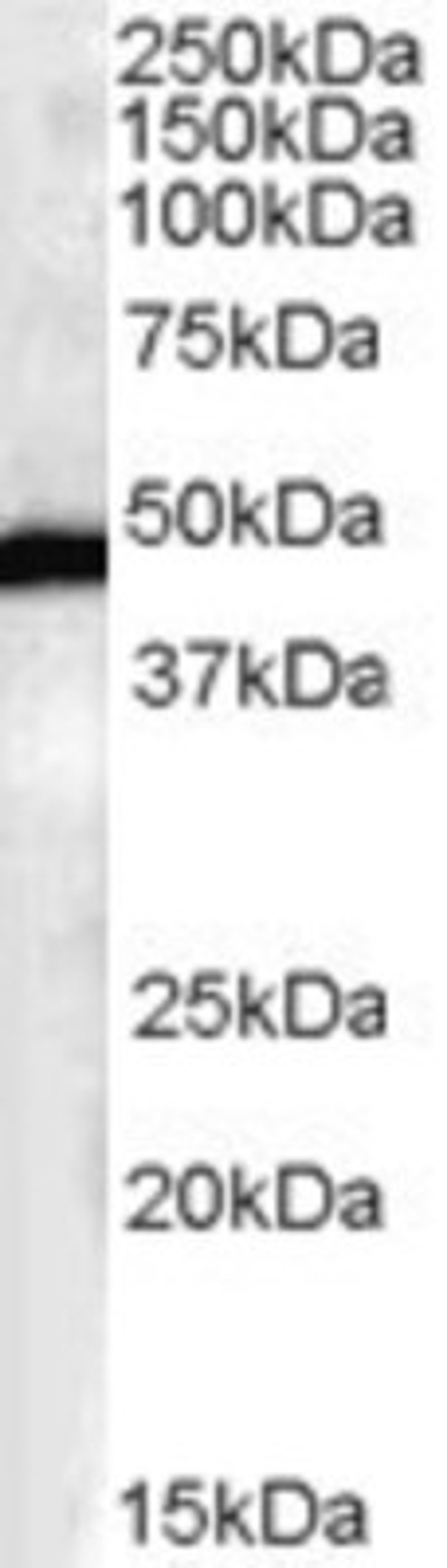 Western Blot: FBXL2 Antibody [NB100-1289] - (0.3ug/ml) of Human Brain lysates (RIPA buffer, 35ug total protein per lane). Primary incubated for 1 hour. Detected by western blot using chemiluminescence.