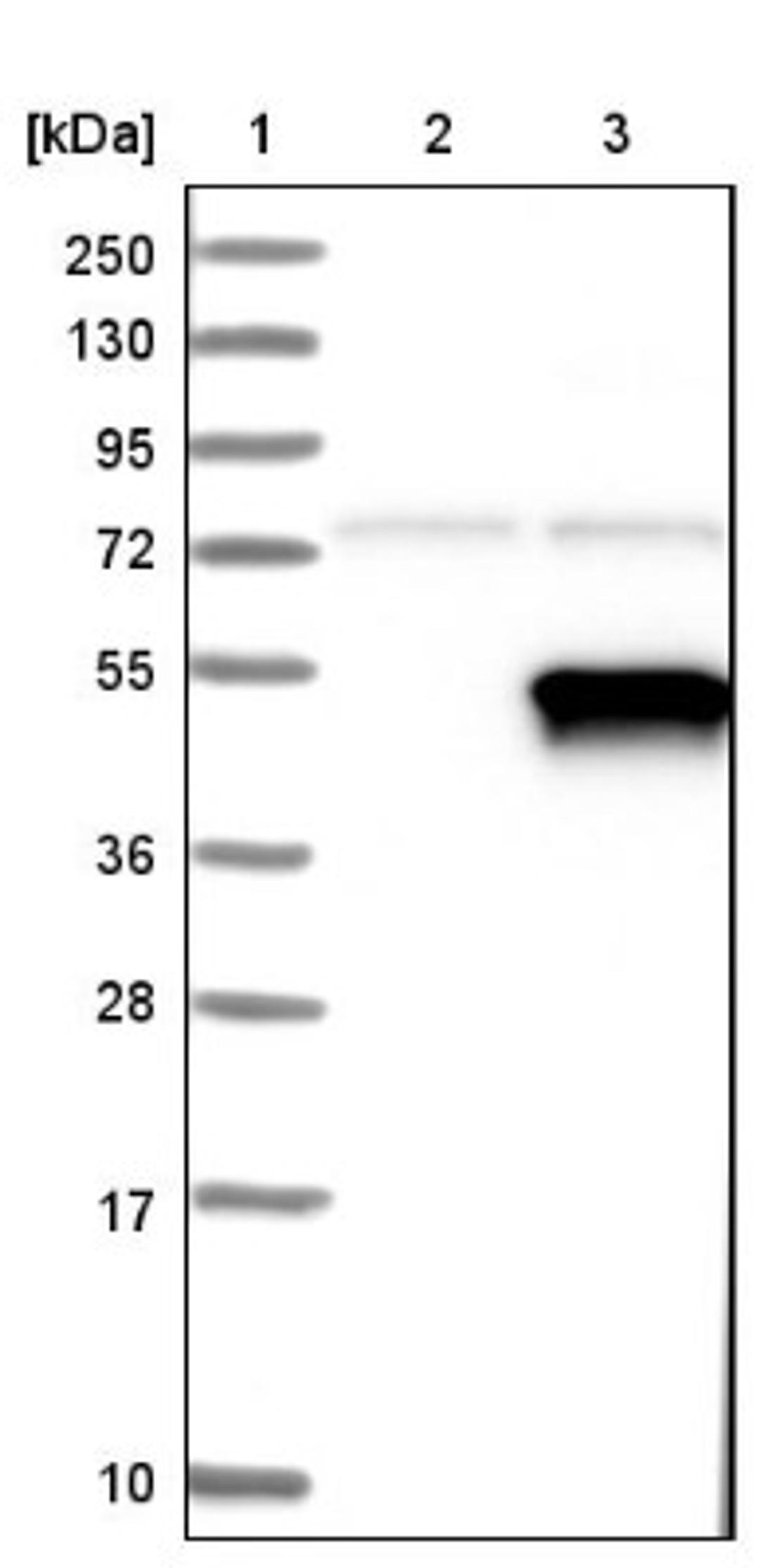 Western Blot: PDK2 Antibody [NBP1-87307] - Lane 1: Marker [kDa] 250, 130, 95, 72, 55, 36, 28, 17, 10<br/>Lane 2: Negative control (vector only transfected HEK293T lysate)<br/>Lane 3: Over-expression lysate (Co-expressed with a C-terminal myc-DDK tag (~3.1 kDa) in mammalian HEK293T cells, LY400923)