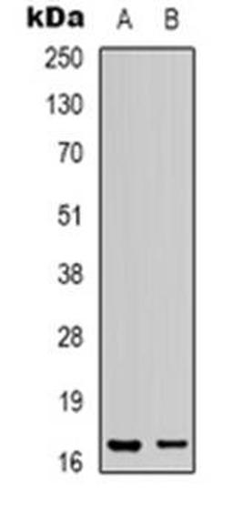 Western blot analysis of LMO3 expression in human heart (Lane 1), COS7 (Lane 2) whole cell lysates using LMO3 antibody