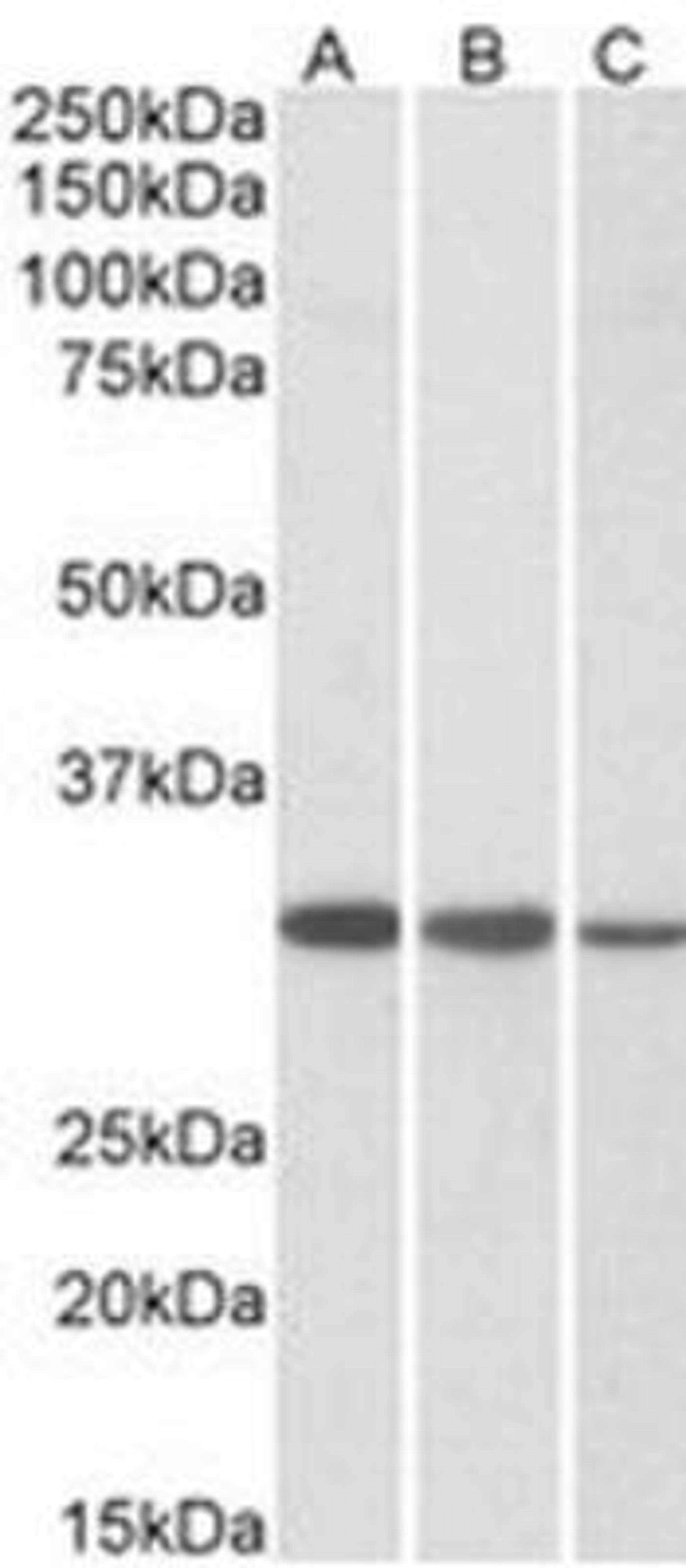 Western Blot: ORC4L Antibody [NB100-798] - Analysis of (A) Jurkat, (B) HeLa, and (C) NIH-3T3 lysates (35ug protein in RIPA buffer).