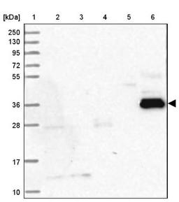 Western Blot: SERINC5 Antibody [NBP2-38369] - Lane 1: Marker [kDa] 250, 130, 95, 72, 55, 36, 28, 17, 10<br/>Lane 2: RT-4<br/>Lane 3: U-251 MG<br/>Lane 4: Human Plasma<br/>Lane 5: Liver<br/>Lane 6: Tonsil