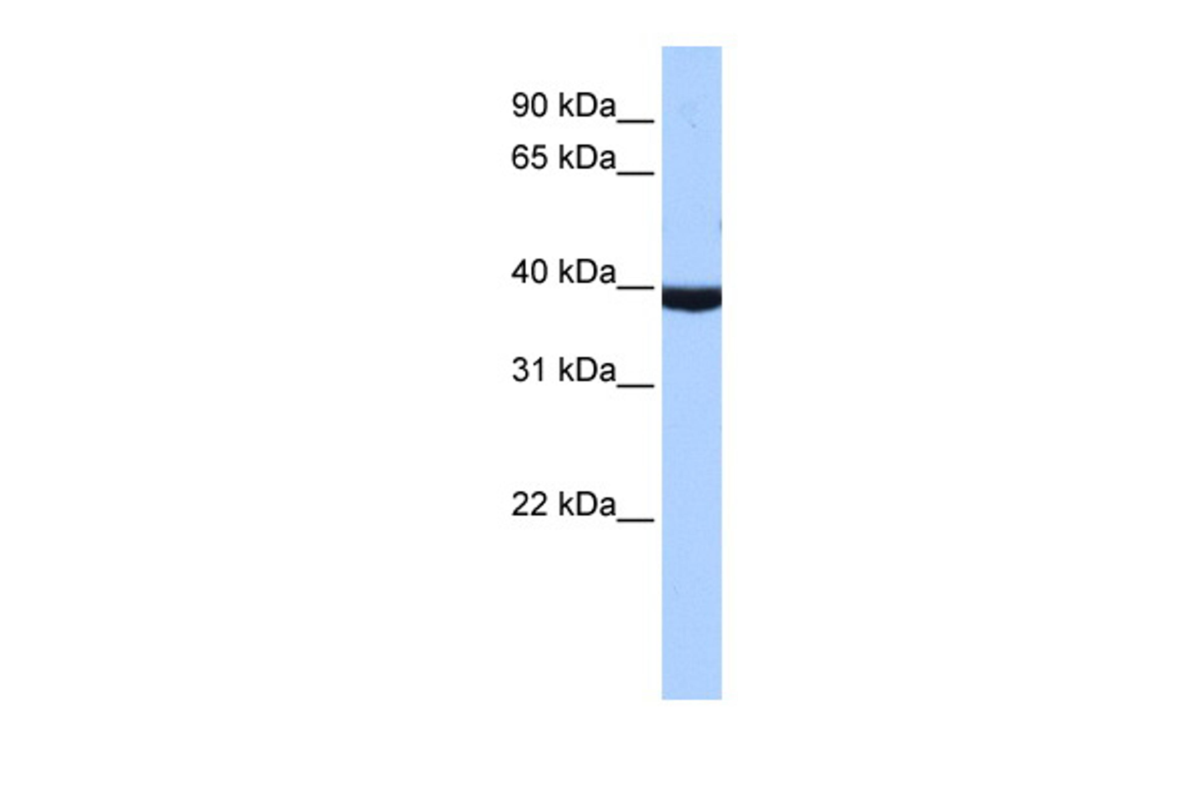 Antibody used in WB on Human MCF-7 at 1 ug/ml.