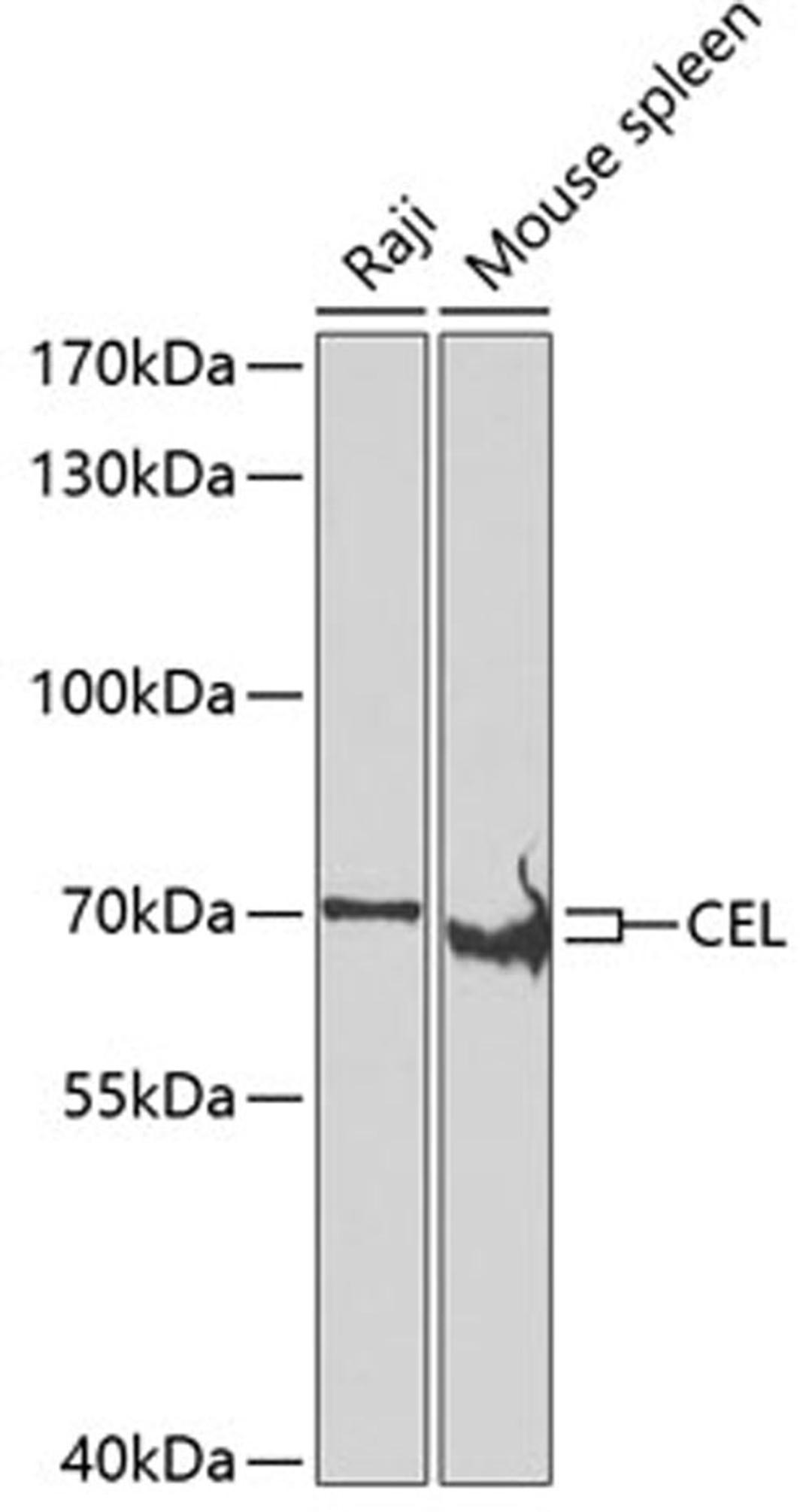 Western blot - CEL antibody (A7652)