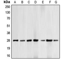 Western blot analysis of HepG2 UV-treated (Lane 1), HeLa (Lane 2), HL60 (Lane 3), THP1 (Lane 4), Jurkat paclitaxel-treated (Lane 5), NIH3T3 H2O2-treated (Lane 6), PC12 H2O2-treated (Lane 7) whole cell lysates using BCL2 antibody