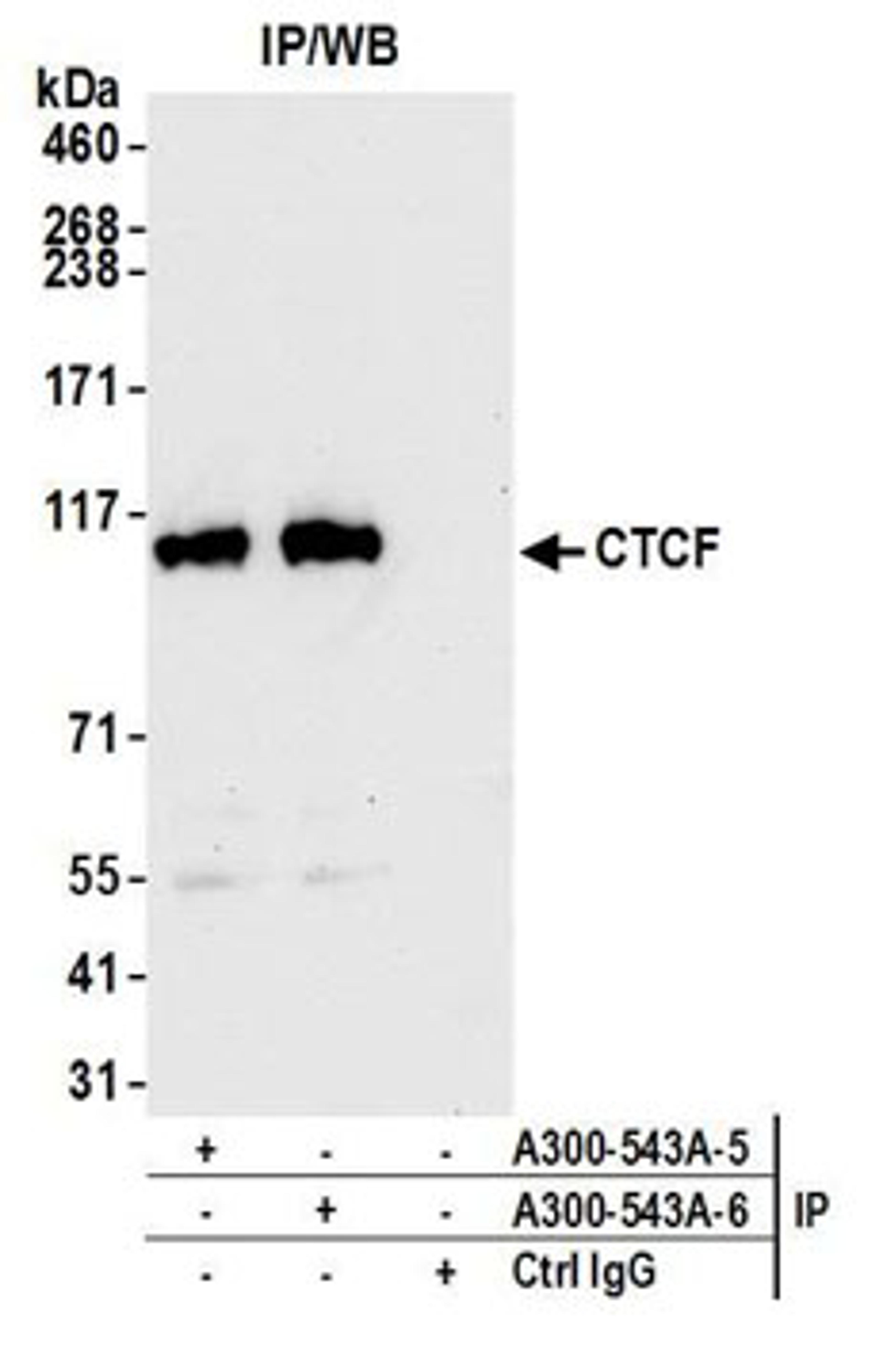 Detection of human CTCF by western blot of immunoprecipitates.