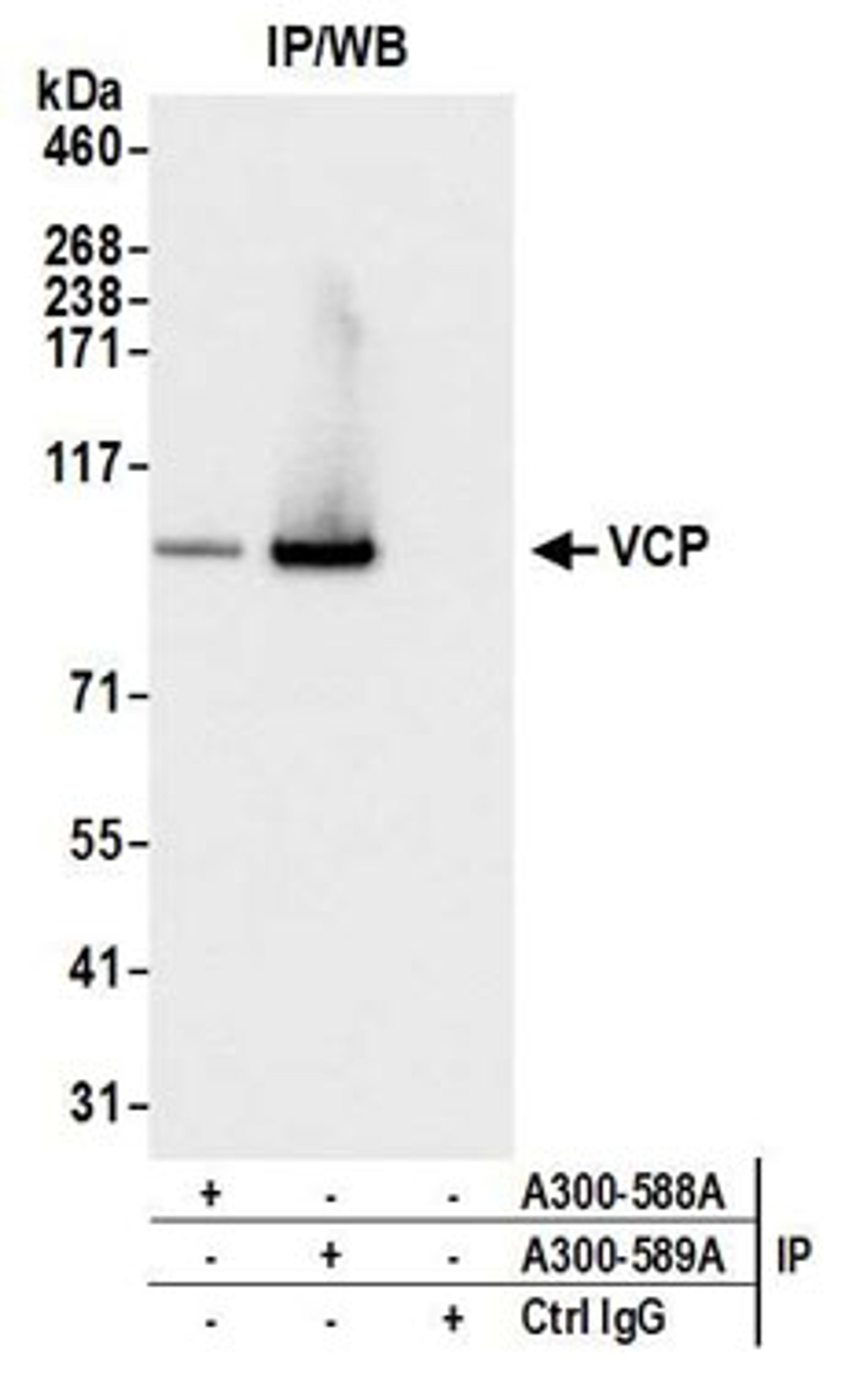 Detection of human VCP by western blot of immunoprecipitates.