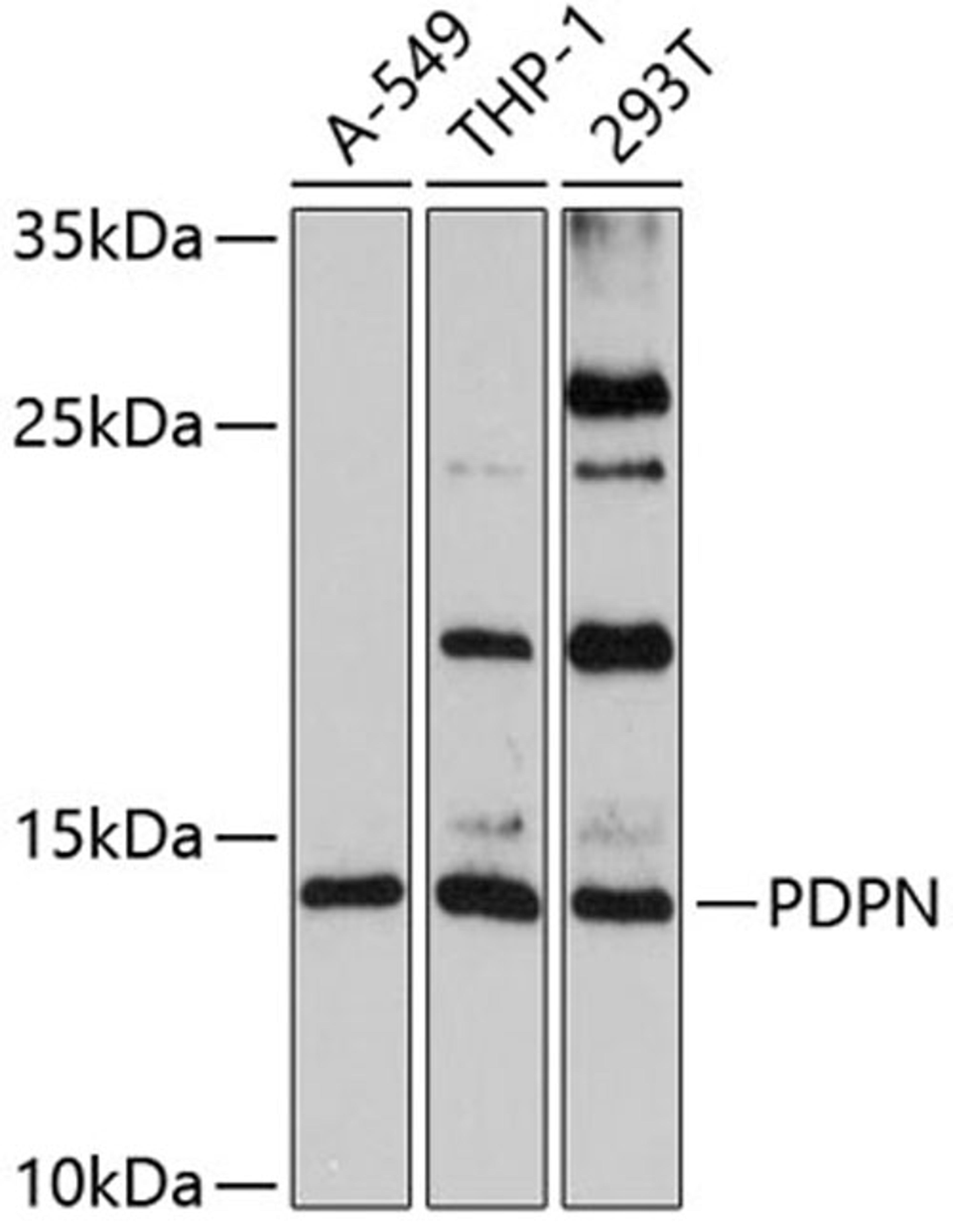 Western blot - PDPN antibody (A7166)