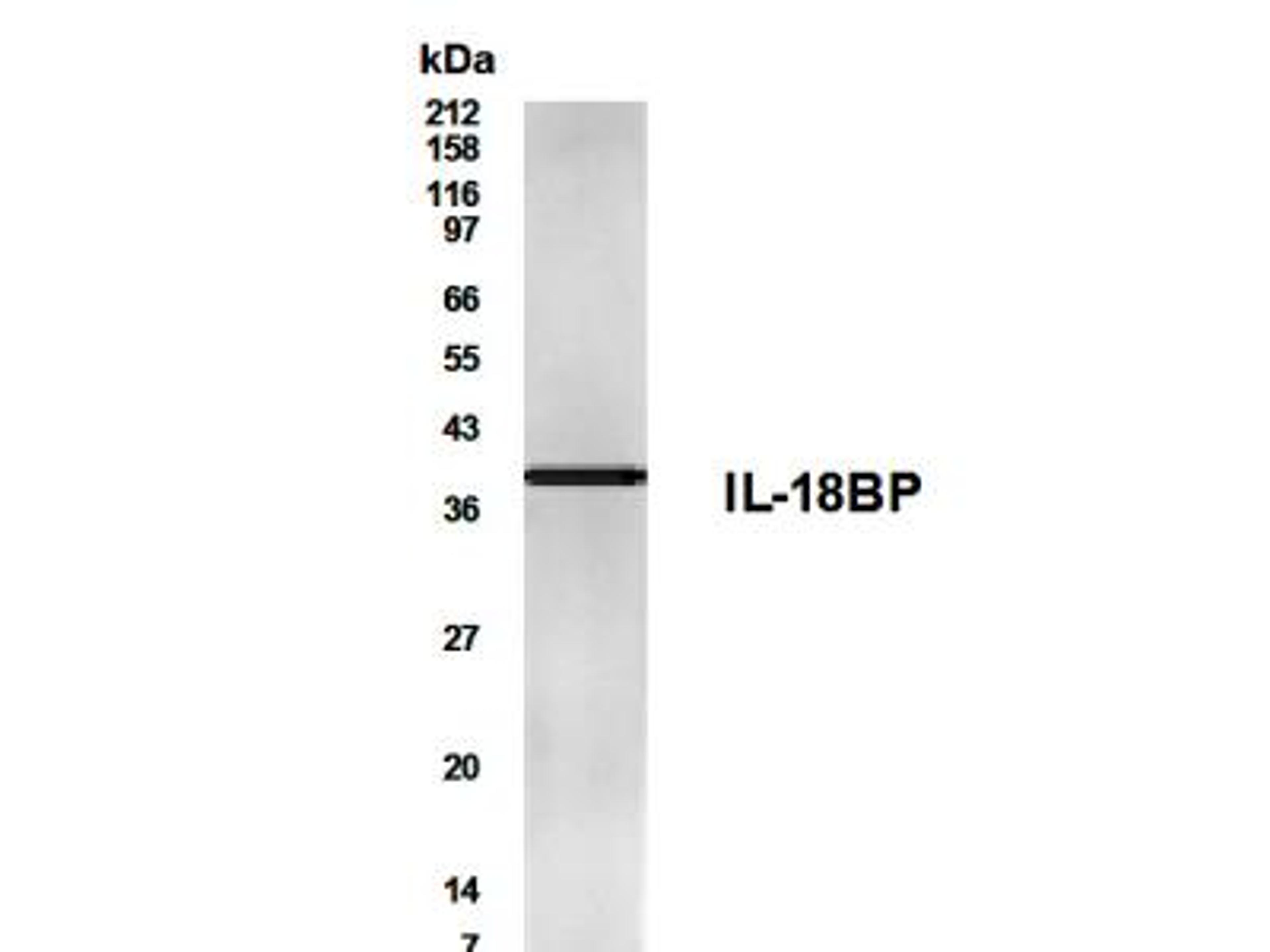 Western Blot: IL18BP Antibody [NB200-201] - WB detection of IL18BP in the lysate of spleen tissue with NB200-201 at a dilution of 1:500