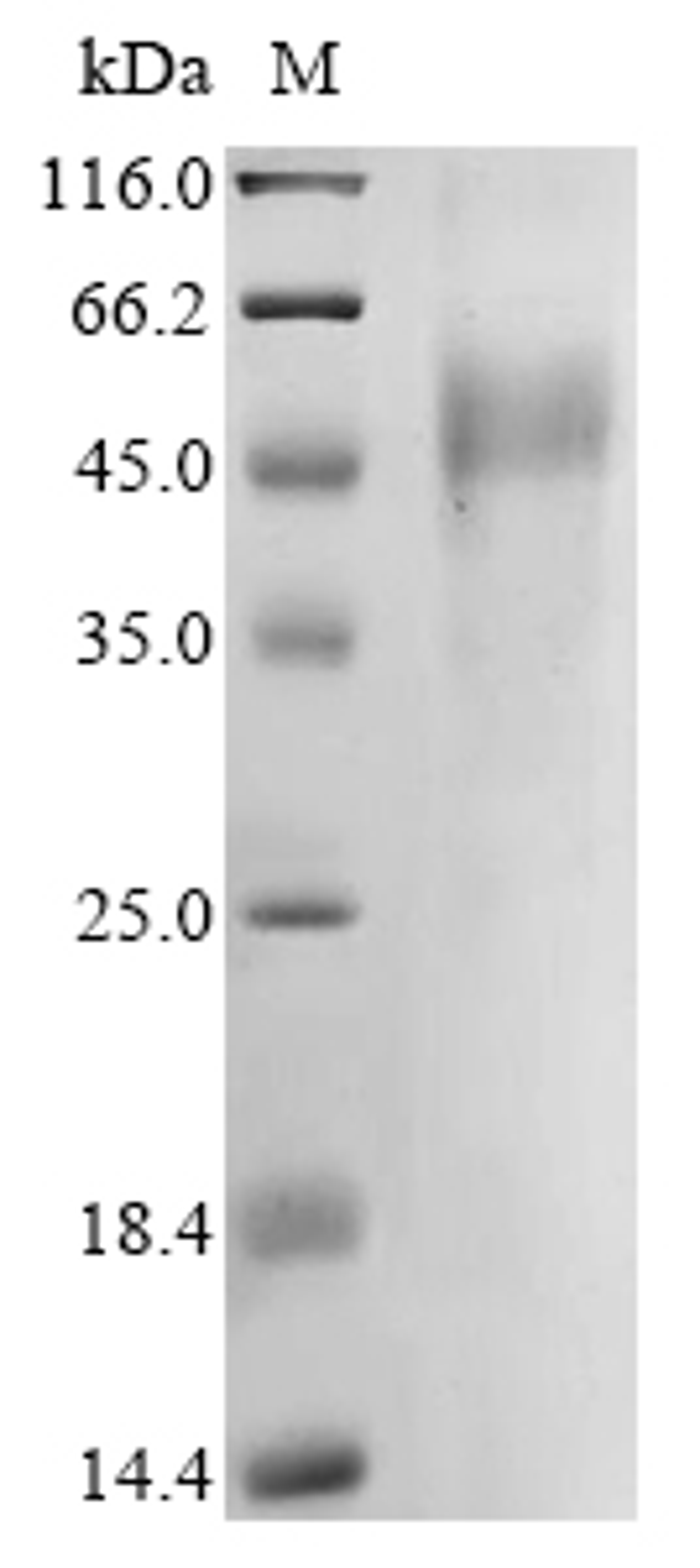 (Tris-Glycine gel) Discontinuous SDS-PAGE (reduced) with 5% enrichment gel and 15% separation gel.