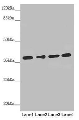 Western blot. All lanes: ERLIN2 antibody at 3.1µg/ml. Lane 1: 293T whole cell lysate. Lane 2: HepG2 whole cell lysate. Lane 3: U251 whole cell lysate. Lane 4: Hela whole cell lysate. Secondary. Goat polyclonal to rabbit IgG at 1/10000 dilution. Predicted band size: 38, 17, 23 kDa. Observed band size: 38 kDa