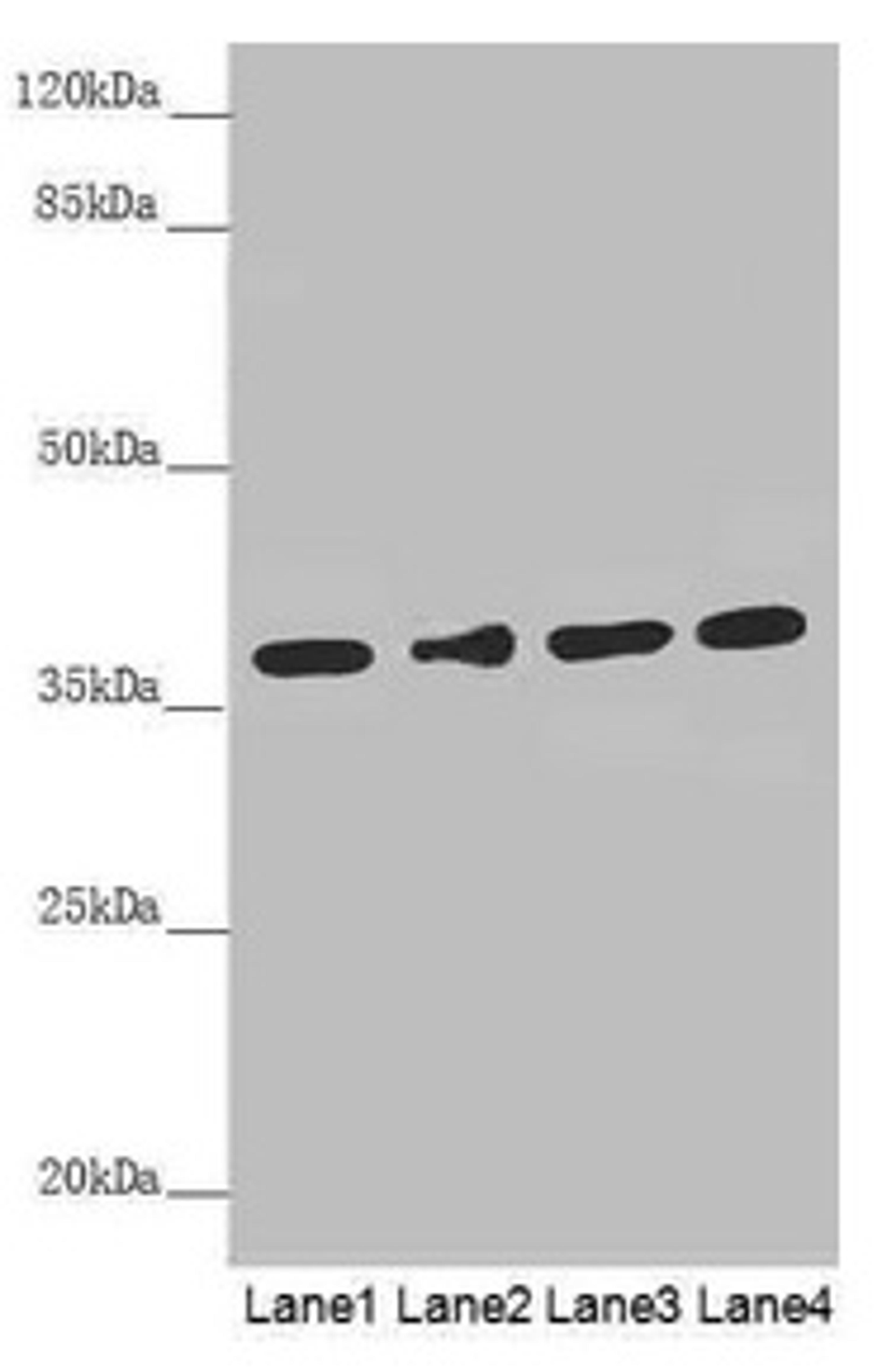 Western blot. All lanes: ERLIN2 antibody at 3.1µg/ml. Lane 1: 293T whole cell lysate. Lane 2: HepG2 whole cell lysate. Lane 3: U251 whole cell lysate. Lane 4: Hela whole cell lysate. Secondary. Goat polyclonal to rabbit IgG at 1/10000 dilution. Predicted band size: 38, 17, 23 kDa. Observed band size: 38 kDa