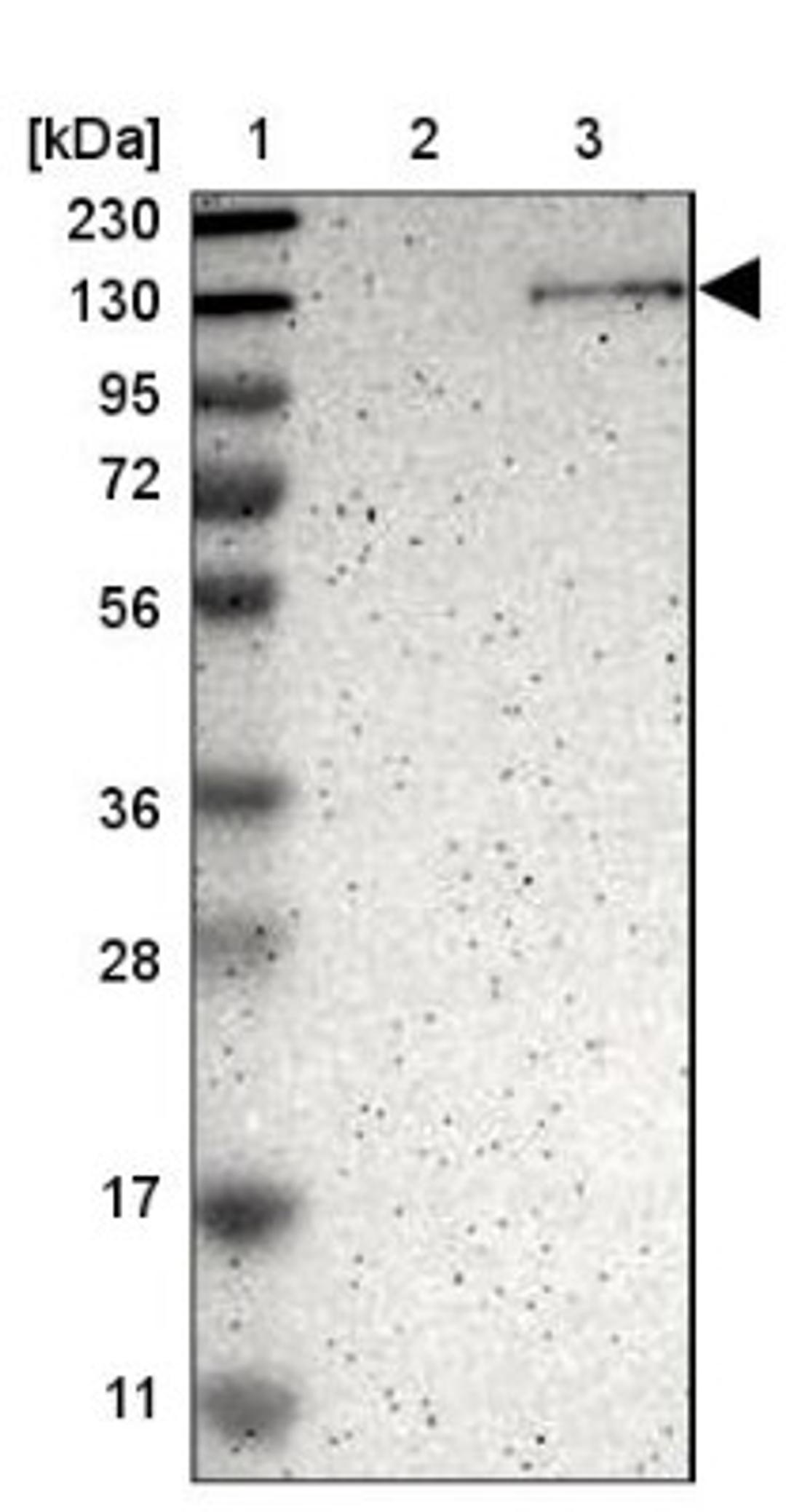 Western Blot: R Cadherin Antibody [NBP1-90370] - Lane 1: Marker [kDa] 230, 130, 95, 72, 56, 36, 28, 17, 11<br/>Lane 2: Human cell line RT-4<br/>Lane 3: Human cell line U-251MG sp