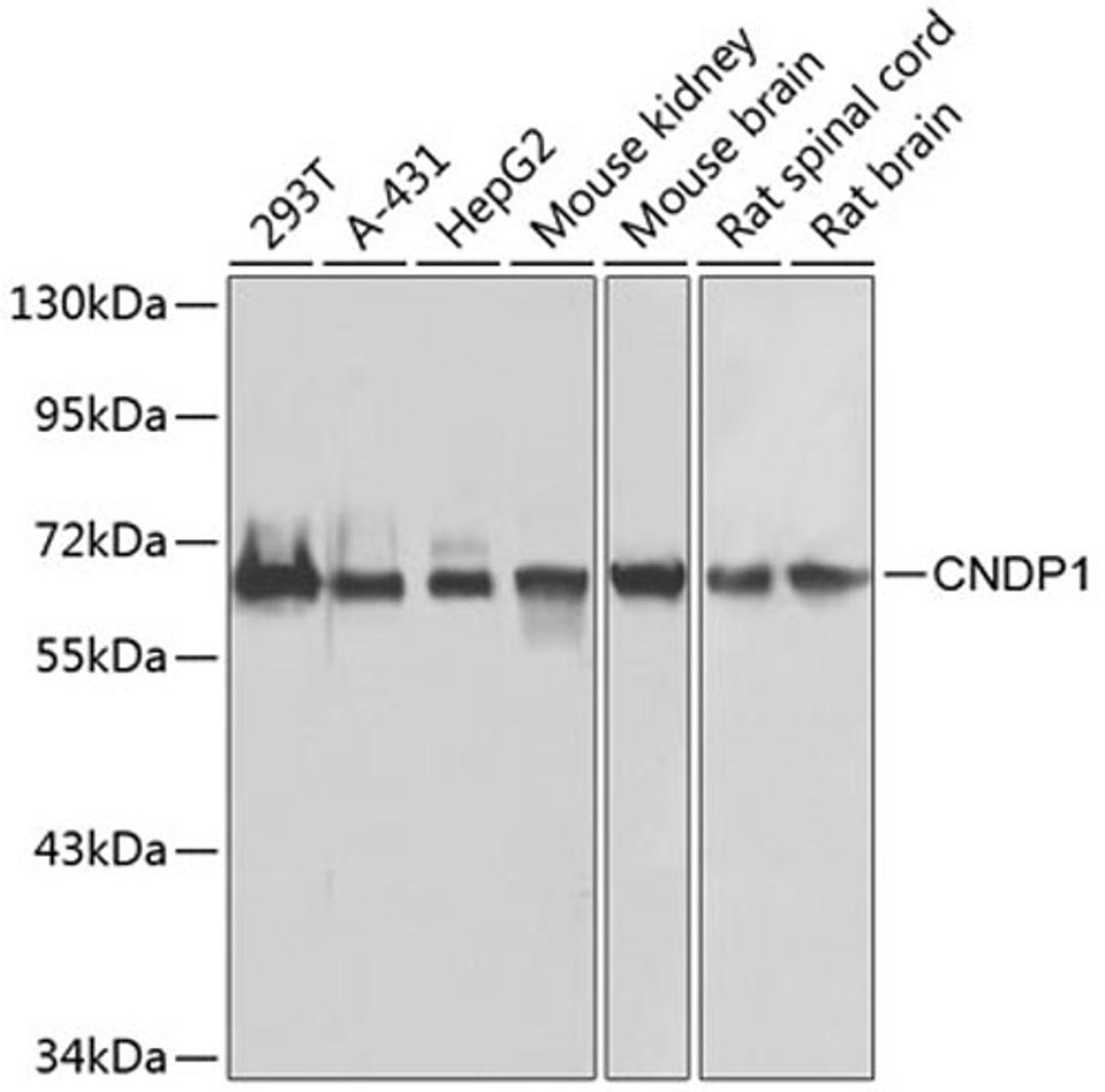 Western blot - CNDP1 antibody (A7485)