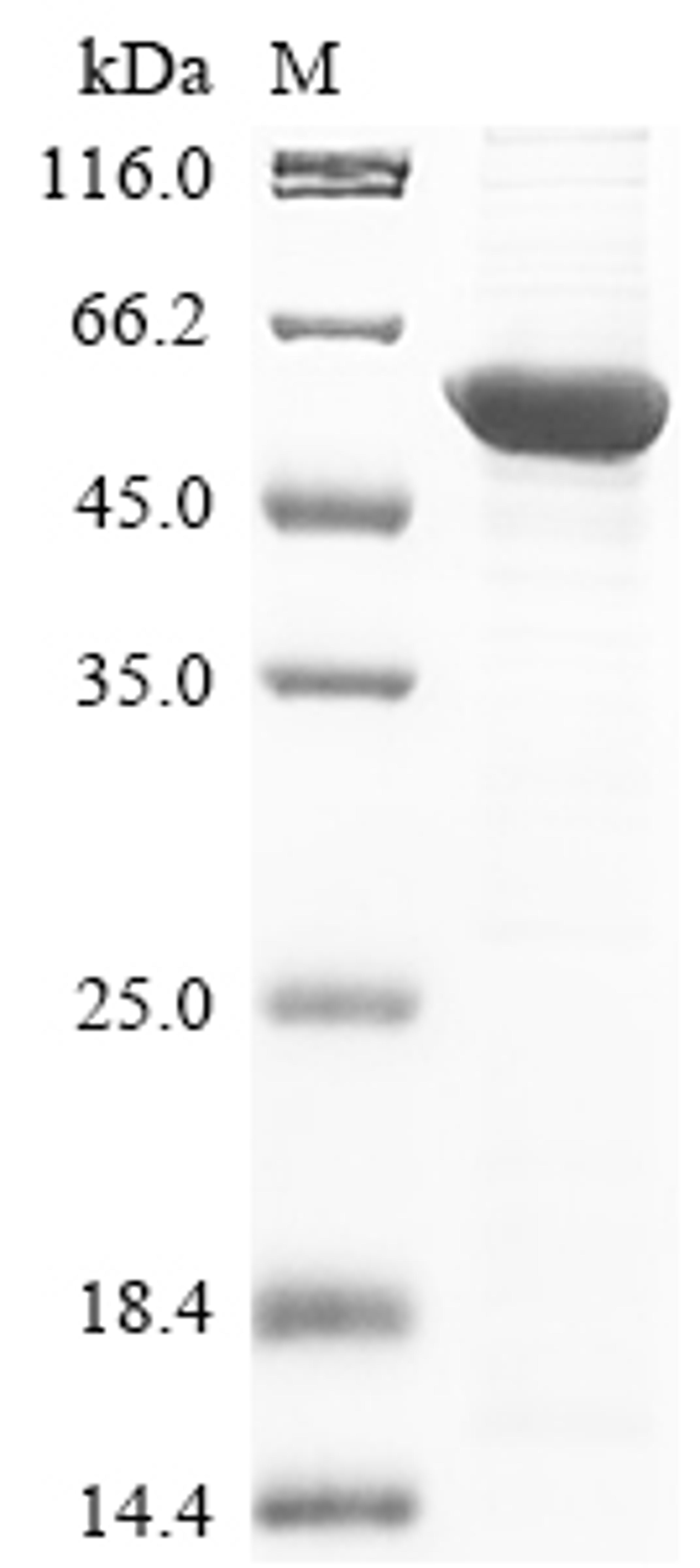 (Tris-Glycine gel) Discontinuous SDS-PAGE (reduced) with 5% enrichment gel and 15% separation gel.