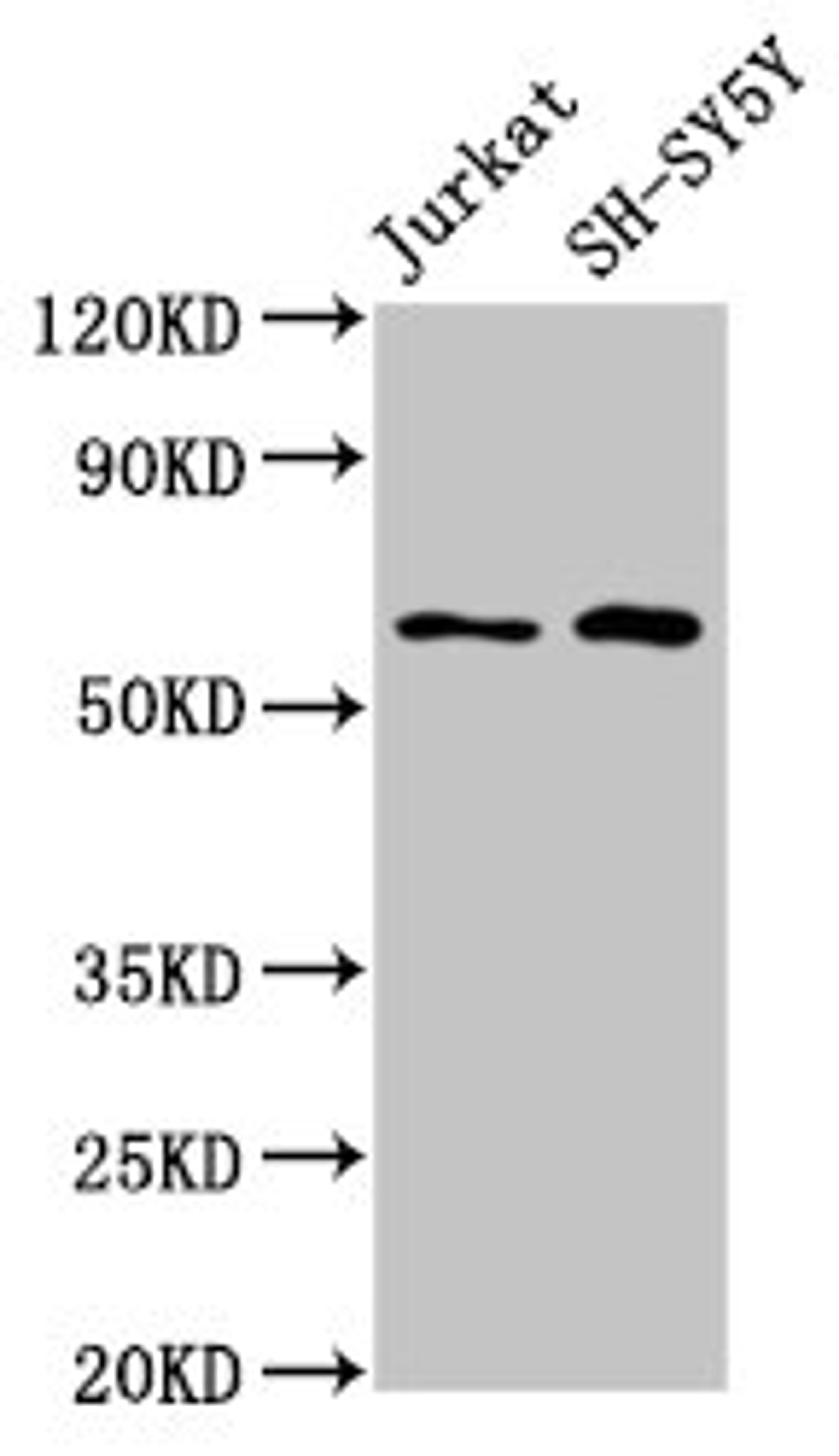 Western Blot. Positive WB detected in: Jurkat whole cell lysate, SH-SY5Y whole cell lysate. All lanes: BORA antibody at 4.8µg/ml. Secondary. Goat polyclonal to rabbit IgG at 1/50000 dilution. Predicted band size: 62, 54 kDa. Observed band size: 62 kDa