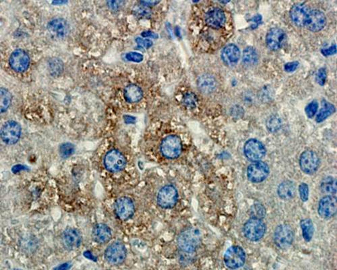 IHC-P staining of mouse liver tissue using anti-MMP9 (dilution at 1:200)