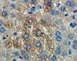 IHC-P staining of mouse liver tissue using anti-MMP9 (dilution at 1:200)