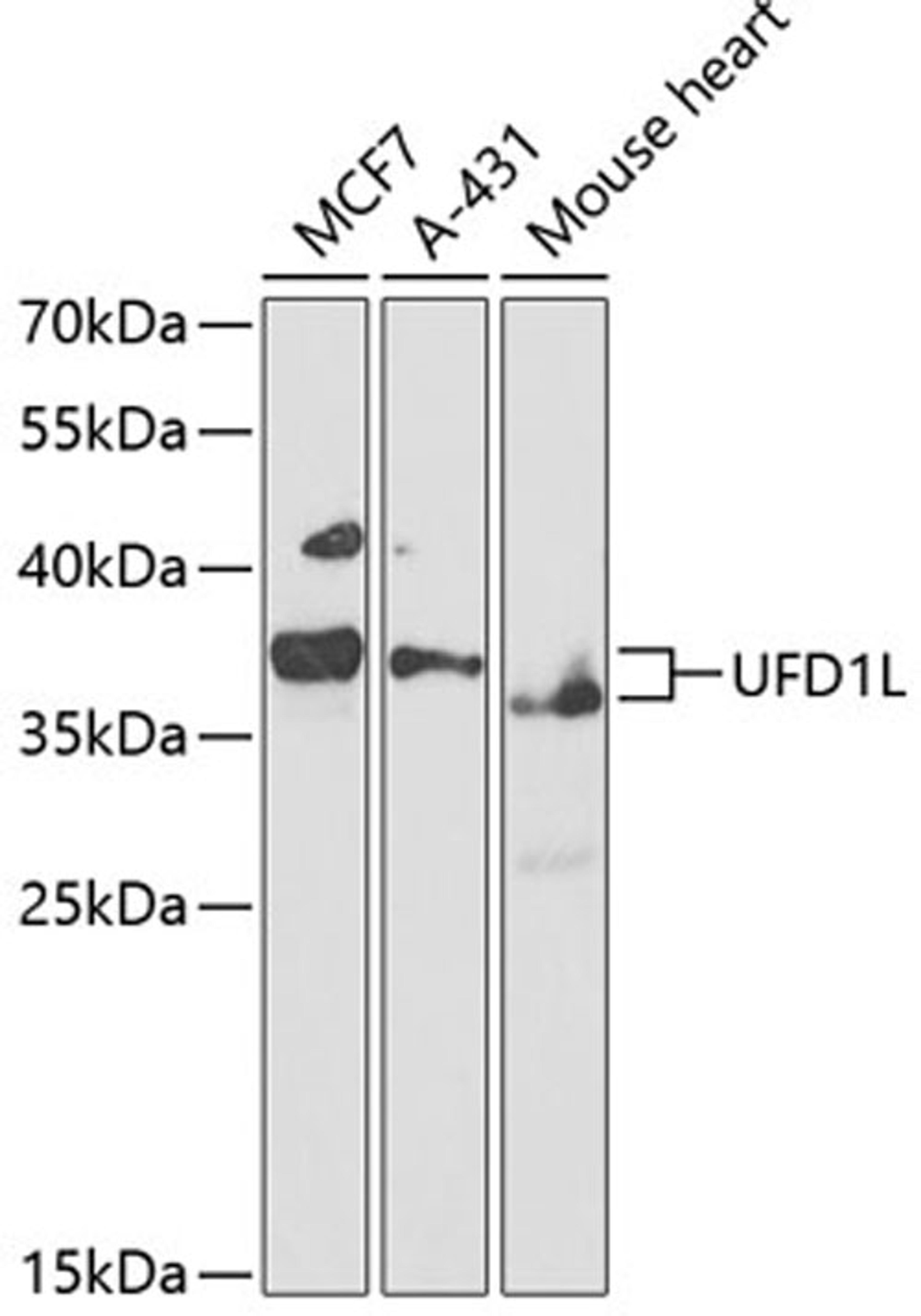 Western blot - UFD1L antibody (A3255)