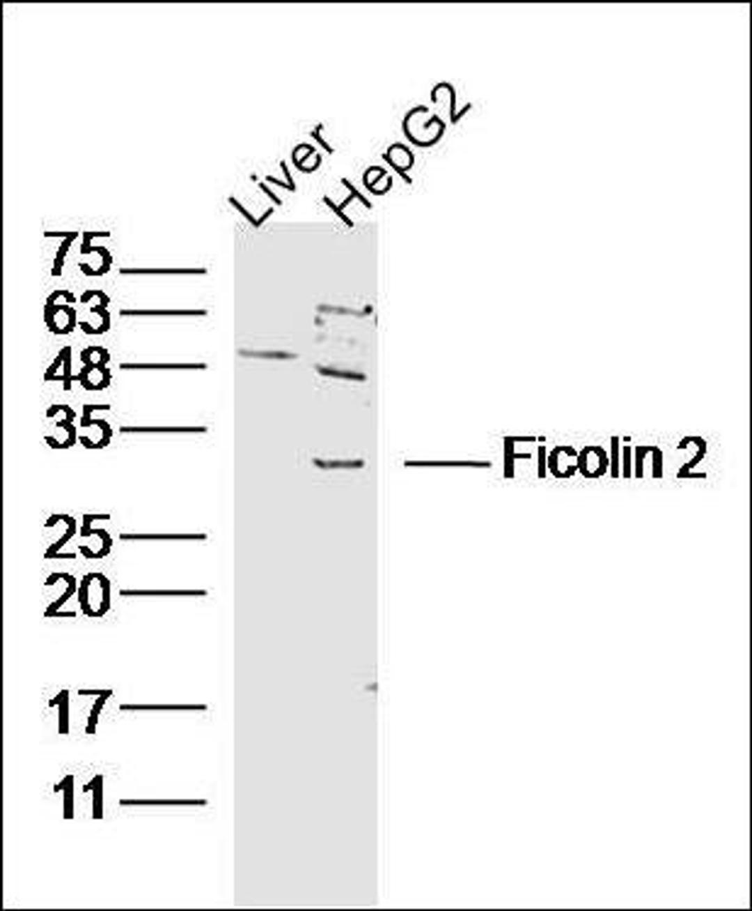 Western blot analysis of Mouse Liver Lysate , Human HepG2 Lysate using Ficolin 2 antibody.