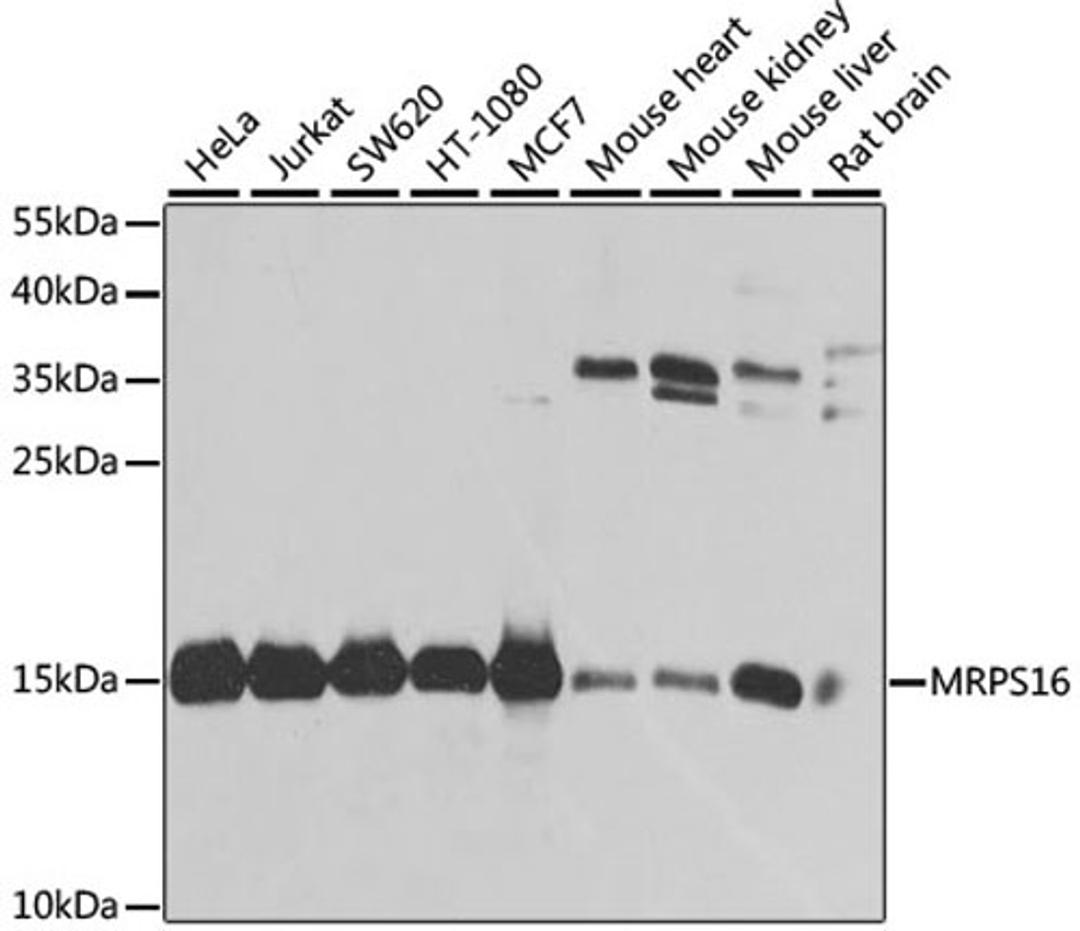 Western blot - MRPS16 antibody (A9874)