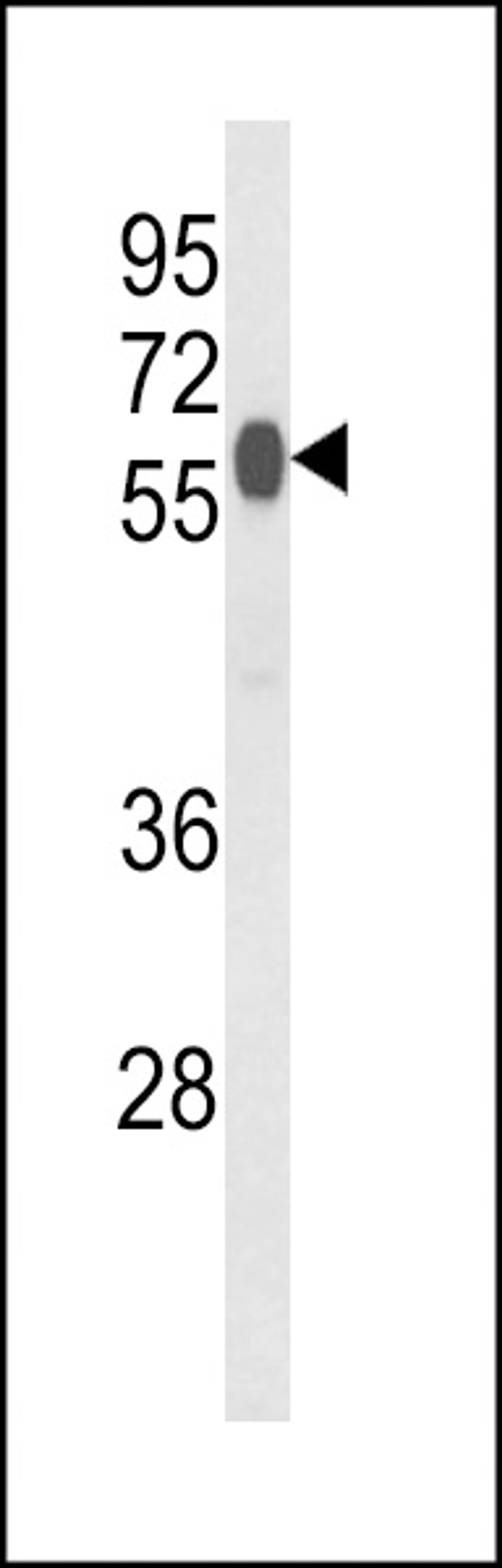 Western blot analysis of PHYH2 Antibody in mouse liver tissue lysates (35ug/lane)