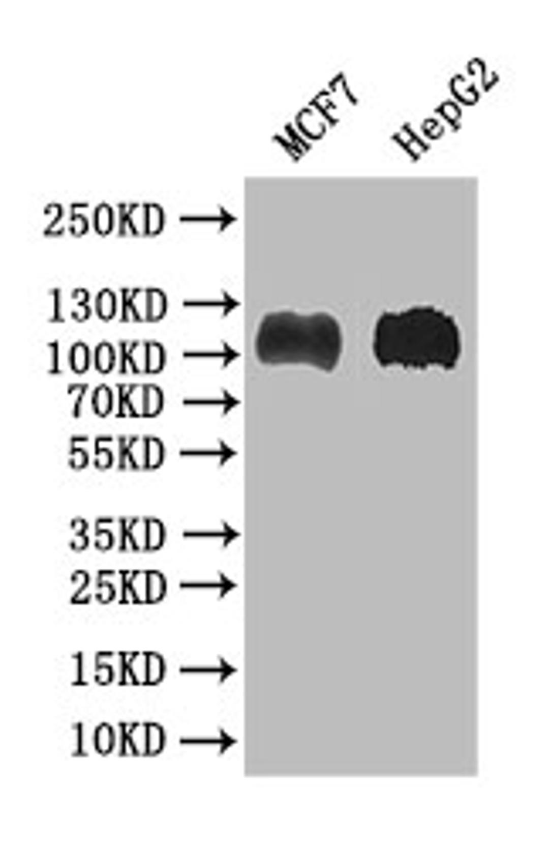 Western Blot. Positive WB detected in: MCF7 whole cell lysate, HEPG2 whole cell lysate. All lanes: BACH1/BRIP1 antibody at 1:1000. Secondary. Goat polyclonal to rabbit IgG at 1/50000 dilution. Predicted band size: 105 kDa. Observed band size: 105 kDa. 