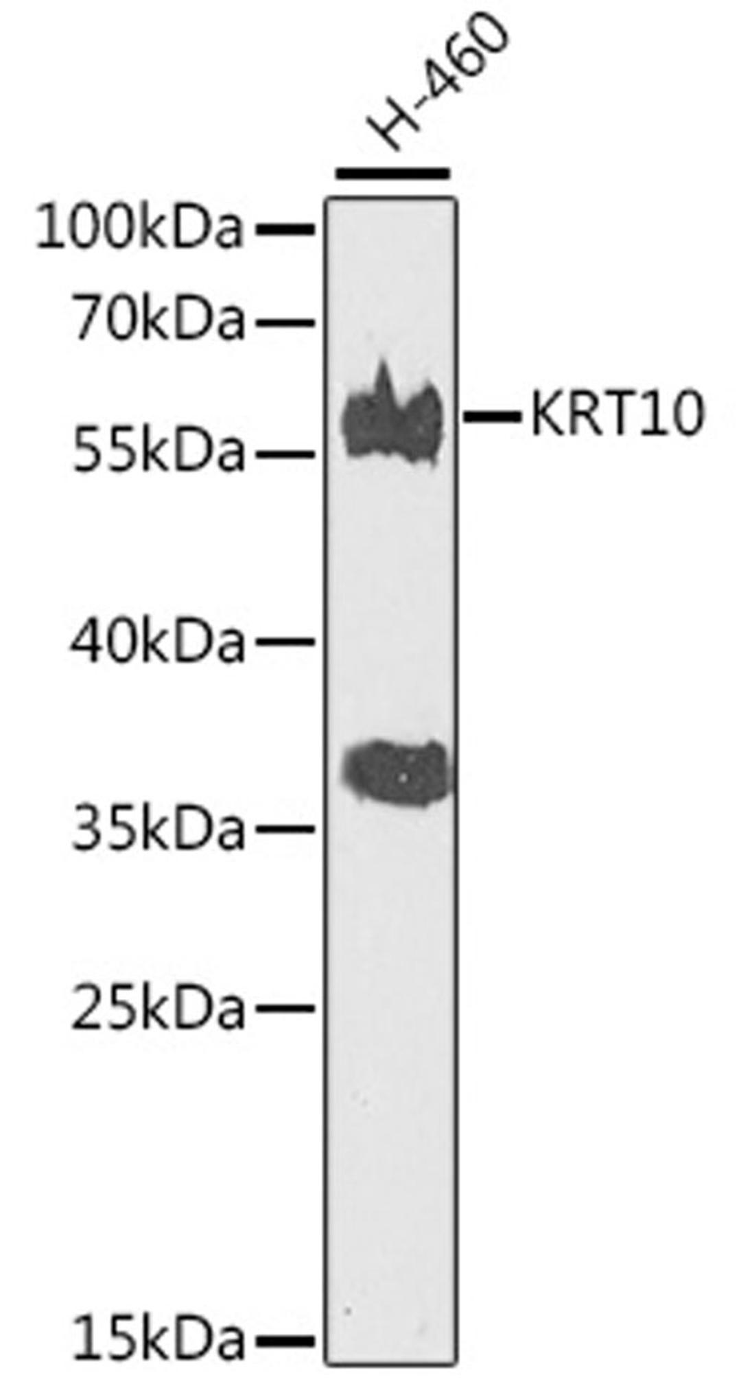 Western blot - KRT10 antibody (A7908)