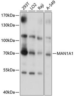 Western blot - MAN1A1 antibody (A10830)