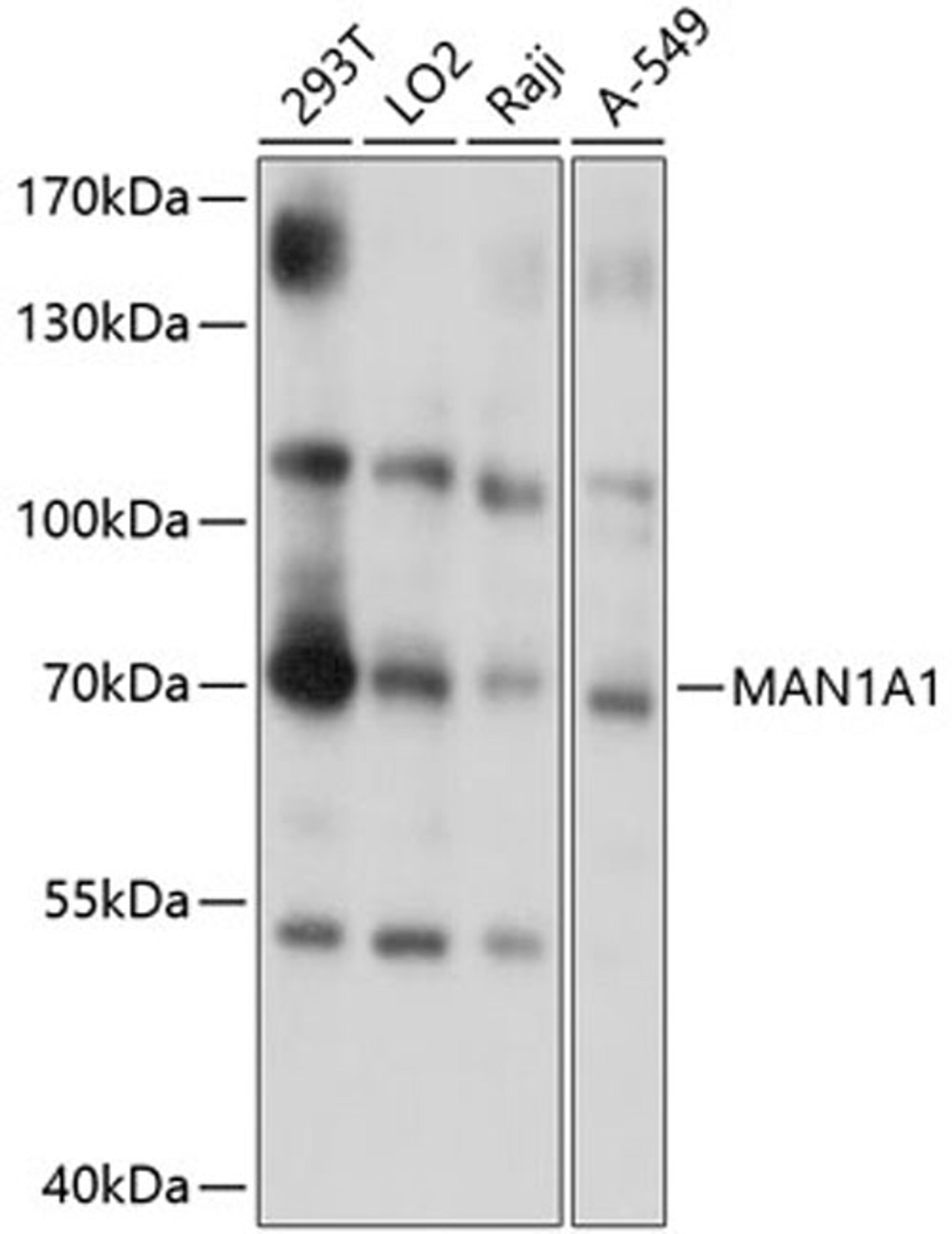 Western blot - MAN1A1 antibody (A10830)