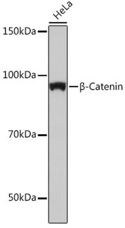 Western blot - ß-Catenin antibody (A19657)