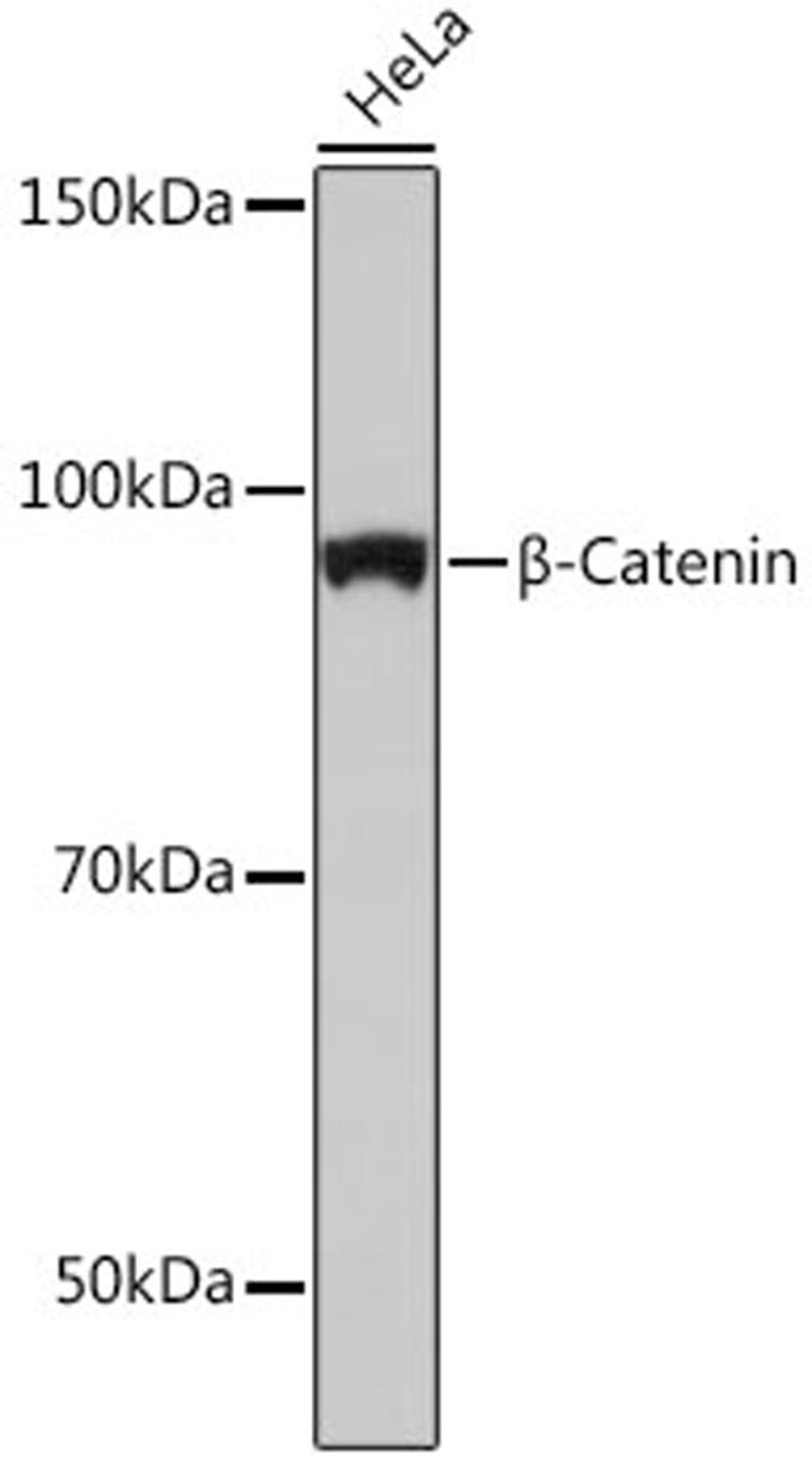 Western blot - ß-Catenin antibody (A19657)